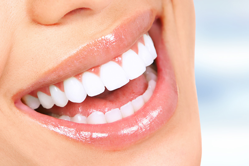 Cosmetic Dentistry in Clemmons